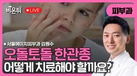 [김형수의 더마talk] 한관종의 치료 / 서울에이치피부과 김형수