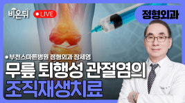 무릎 퇴행성관절염의 조직재생치료 / 부천스마튼병원 정형외과 장세영
