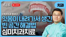 (대구) 잇몸내려가서 생긴 빈 공간 해결방법, 심미치과치료 / 정성치과 정성국