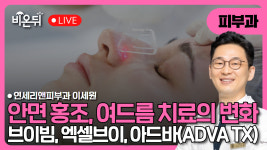 안면홍조, 여드름 자국 치료 레이저의 패러다임 변화 : 브이빔, 엑셀브이, 아드바(ADVA TX) / 연세리앤피부과 이세원