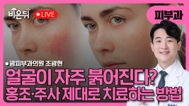 얼굴이 자주 붉어진다면? 홍조·주사 제대로 치료하는 방법 / 광피부과의원 조광현