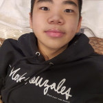 붕어빵 아들이 여드름 피부까지 닮을까봐 한달에 3번 피부과 보내는 정종철