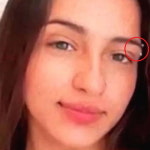 셀프 피어싱 했다가 세균 감염으로 얼굴 퉁퉁 부어 결국 사망한 15살 여중생