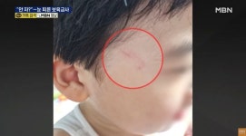 낮잠 안 잔다는 이유로 4살 아이 눈 찌른 전북 군산의 어린이집 교사 (영상)