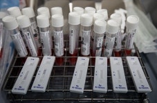 방역 당국 한의원도 전문가용 신속항원검사 권한 부여 검토 중