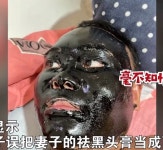 코에 붙이는 팩 마스크팩인 줄 알고 얼굴 전체에 바른 화알못 남성의 최후