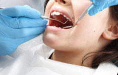 치과 의사가 공개한 양치 제대로 안 한 사람의 치석 제거 영상