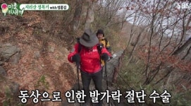 생살 썩어들어가는 고통...산 타다가 동상 걸렸던 산악인의 몸상태
