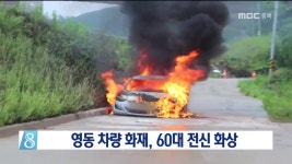 영동 차량 화재, 60대 전신 화상