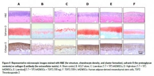 세계 최초 퇴행성관절염 자가 줄기세포치료제 조인트스템 작용기전 규명, 국제 학술지 게재