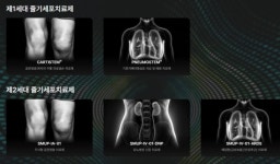 메디포스트, 카티스템 日 품목허가 타임라인 가동…CB 스텝업 회피 정중동