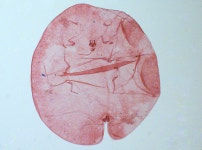 많은 양의 감로 분비, 열매 피해 및 그을음병 유발