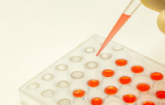 ASC, 8인자 유전자 치료제 임상시험 투여 시작