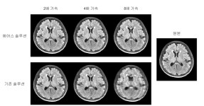 MRI 촬영시간 10분으로…에어스메디컬 투자 유치