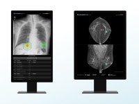 루닛, GC녹십자아이메드에 AI 암 진단 솔루션 공급