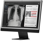 “X-ray 한 장으로 골다공증 찾는다”…프로메디우스, 215억 투자 유치