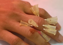 한봉희의 100세 건강 [13] 금침은 안전하다