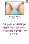 [카드뉴스]장마철 백선(무좀)에 주의하세요