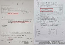 [단독]동일 진단서, 한 보험사만 無지급 무심코 동의한 의료자문 발목