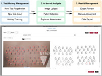 아모레퍼시픽이 개발한 AI 피부 자극 자동 진단 기술의 성과는?