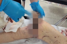 환자를 장기 방치한 서귀포공립요양원을 고발합니다