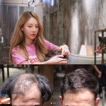 커트만 ‘11만 5000원’ 탈모 특효라는 강남 미용실, 어떻길래?