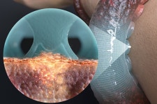 한국콜마, 문어 빨판 모사 기술 적용 화장품 개발한다