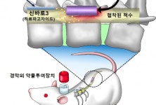 한약재 ‘천수근’ 천연물로 척추관협착증 극복한다