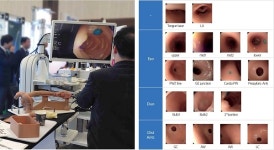 애니메디솔루션, 국내 최초  상부위장관내시경 트레이닝시스템 선봬