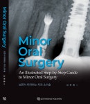 치과에서도 다양한 수술 한다고요?