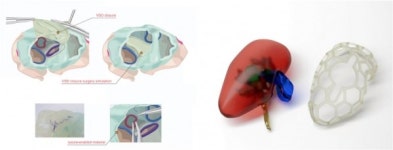 세상을 출력하는 3D프린팅, 생명을 만들어내다