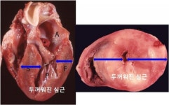 [반려동물 건강이야기] 고양이 돌연사 주범 '심근비대증', 언제부터 약 먹어야 할까?