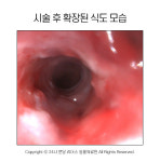 [반려동물 건강이야기] 식도협착으로 발생한 고양이 구토, 이것으로 치료해요!
