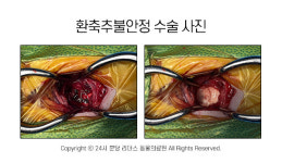 [반려동물 건강이야기] 사지가 마비될 수 있는 질환?! 강아지 환축추불안정