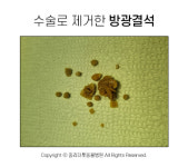 [반려동물 건강이야기] 재발률 높기로 악명 높은 방광결석...예방·관리에 힘써야!