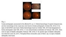 경희생한의원 김지만 원장 당뇨망막병증 맞춤 한약 치료 연구 논문 SCI 국제 학술지에 게재