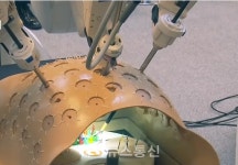 글로벌 수준 의료기기 연구개발 본격 시작