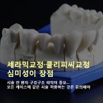 [카드뉴스] 세라믹교정·클리피씨교정, 심미성 장점
