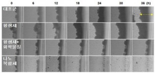 골칫덩이 바이오필름, 나노복합체로 안녕~