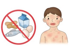 알레르기 비염 예방관리 수칙, 환경조절이 무엇보다 중요
