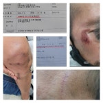 단체폭행 일어난 안동 식당, 김형동 의원은 왜? 조용히 빠져 나갔나