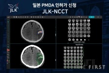 제이엘케이, 뇌졸중 AI 솔루션 JLK-NCCT 일본 PMDA 신청