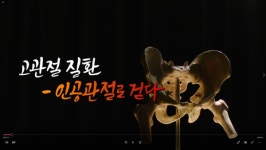 [EBS 명의] 정형외과 박윤수·박재형 교수가 말하는 '고관절 골절과 통증, 고관절 질환의 치료와 수술방법은?'