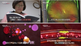 생로병사의 비밀, 노화(Aging)를 부르는 최종당화산물(AGEs) 일명 당독소 개선 방법은?