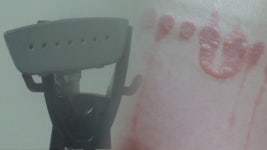 궁금한이야기Y 부산 먹방BJ 데이트 폭력, 다리미로 화상 입히고 체벌 주장