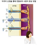 유전자 요법으로 치아 상아질 재생…치과 치료의 새 패러다임
