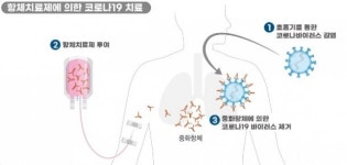 코로나19 치료제 국내 임상 19건 진행 중… 2상 9건ㆍ3상 2건