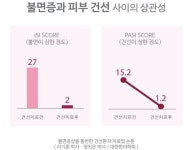 건선, 불면증 때문에 생길 수 있다?