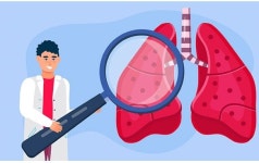 결핵 적정성 1등급 의료기관 53.4%…내성진단 검사율 향상