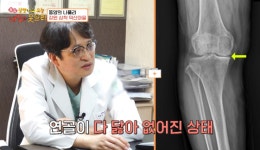 덕산정형외과(자판기) | 유정수 병원장, SBS '살맛나는 오늘'서 의료 봉사... 퇴행성관절염 인공관절 수술 시행